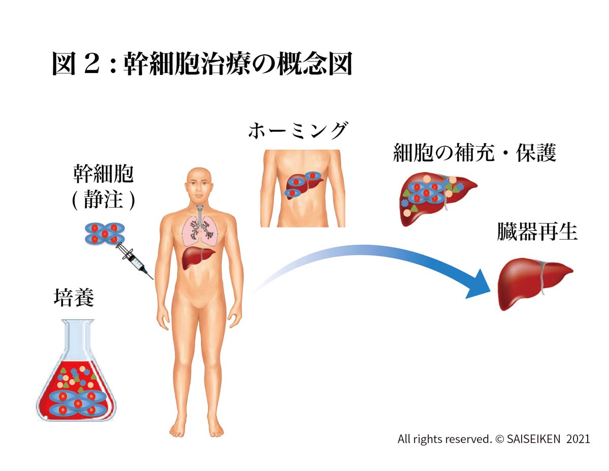 幹細胞治療の概念図