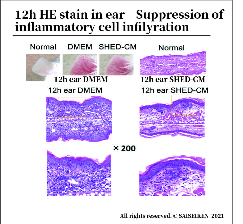 12h HE stain in ear　Suppression of inflammatory cell infilyration