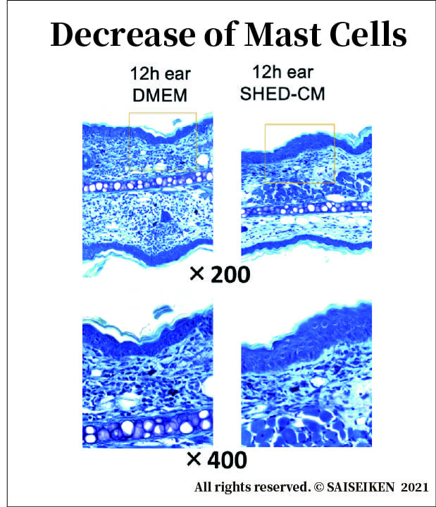 Decrease of Mast Cells