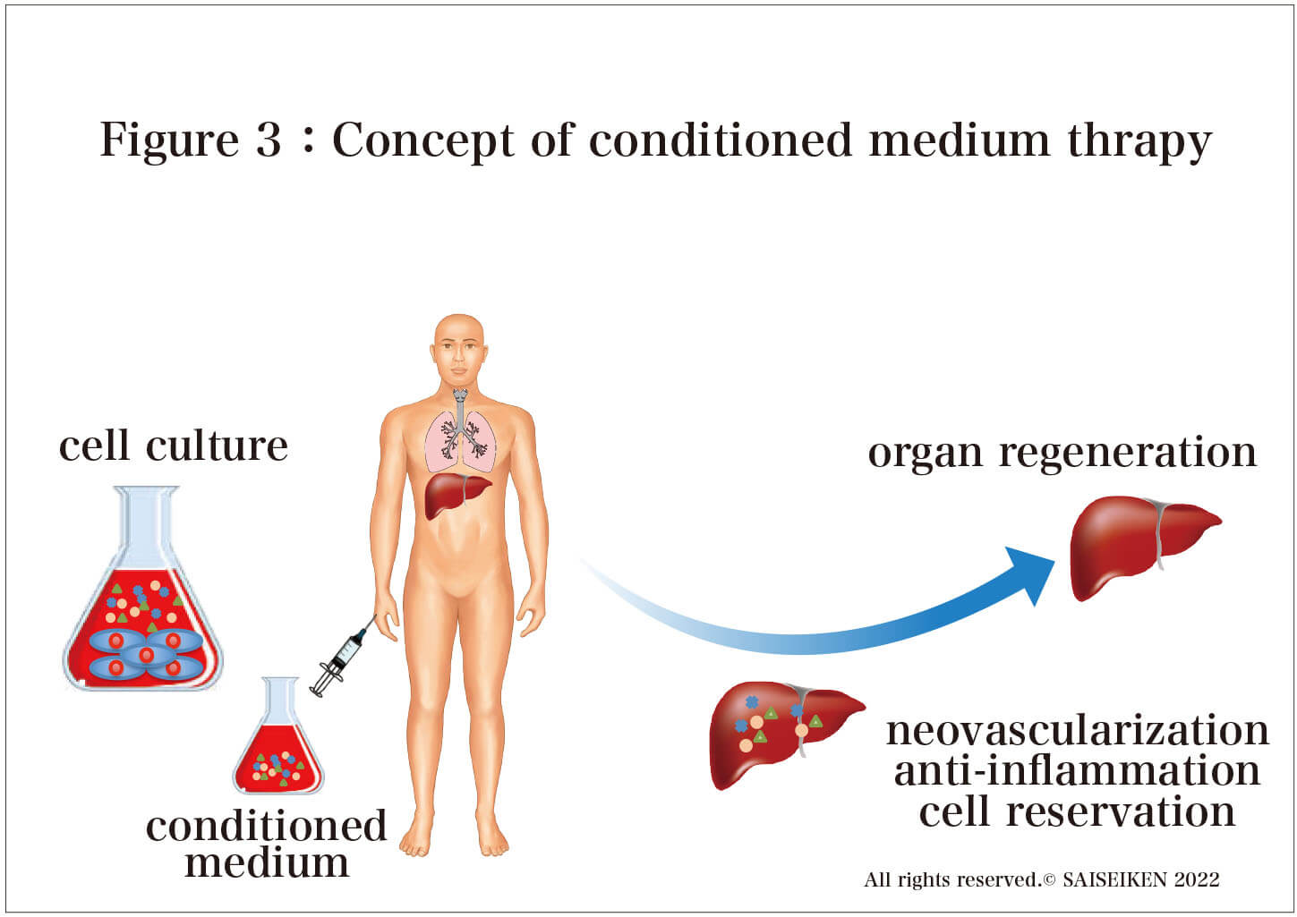 Concept of conditioned medium thrapy